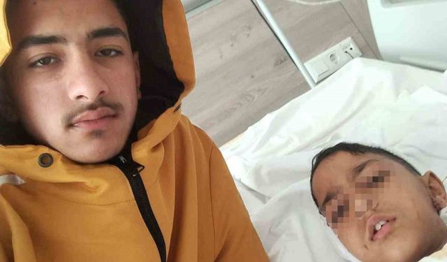 Ankara'da sokak köpeğinin saldırısına uğrayan çocuk yaralandı