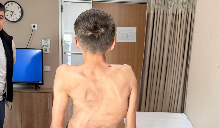 Kırgızistanlı genç şifayı Türk hekimlerinde buldu